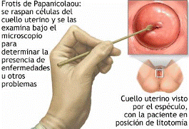 Tocogyn, S.L. citología